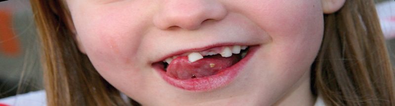 Pediatrische tandheelkunde en homeopathie foto metazahren-com