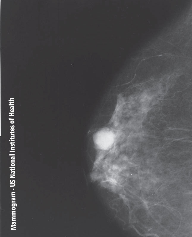 Mammogram - US National Institutes of Health