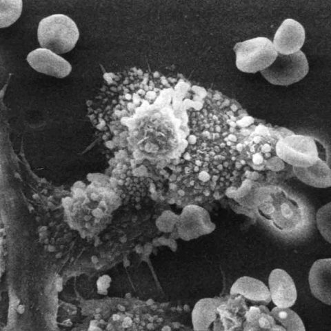 Macrofagen vernietigen een kanker cell Public domain afbeelding by Dr. Raowf Guirguis, US National Cancer Institute