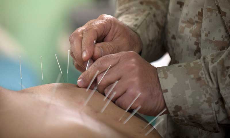 By Official Navy Page from United States of AmericaDominique Pineiro/U.S. Navy - Cmdr. Yevsey Goldberg conducts an acupuncture procedure., Public Domain, https://commons.wikimedia.org/w/index.php?curid=22674824